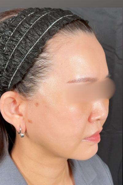 手术前的状态 其一