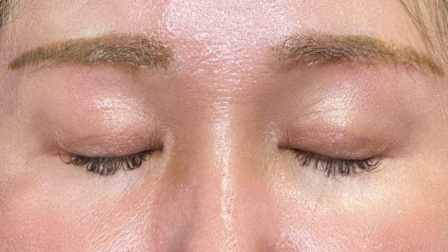 Postoperative Condition Part 1