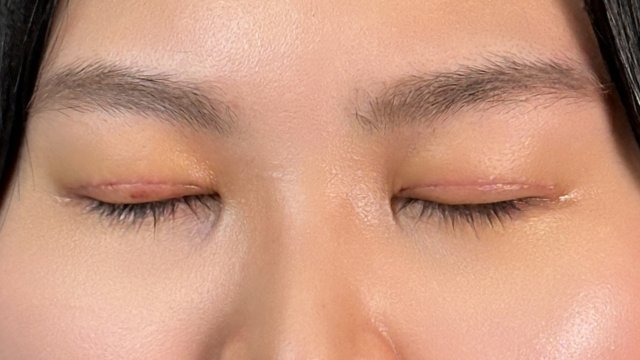 手术前的状态 其一