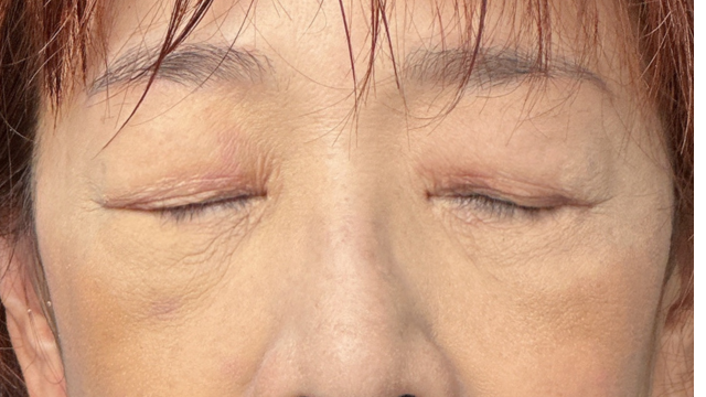 手术前的状态 其一