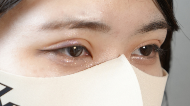 手术前的状态 其一