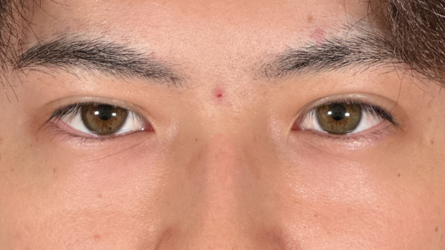 Postoperative Condition Part 1