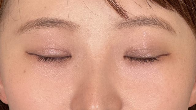 Postoperative Condition Part 1