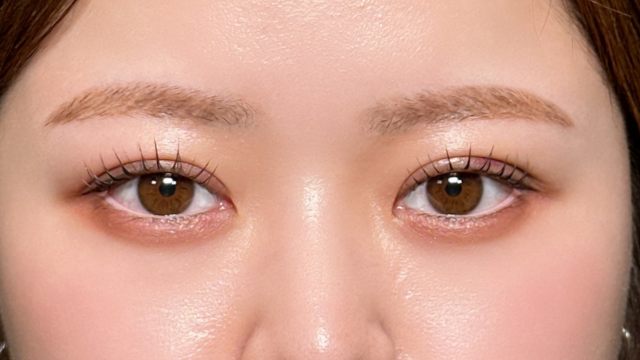 手术前的状态 其一