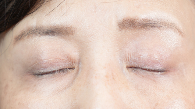 手術前の状態 その1