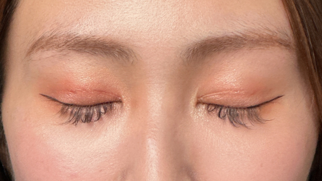 手術前の状態 その1