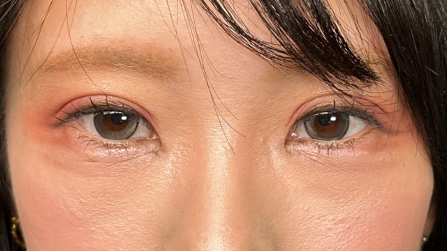 手术前的状态 其一