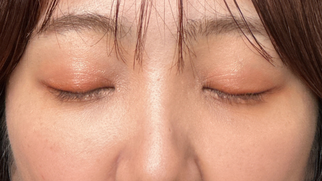 Postoperative Condition Part 1