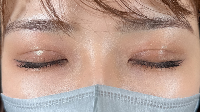 手术前的状态 其一