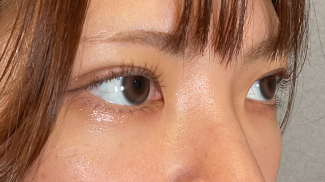 手术前的状态 其一