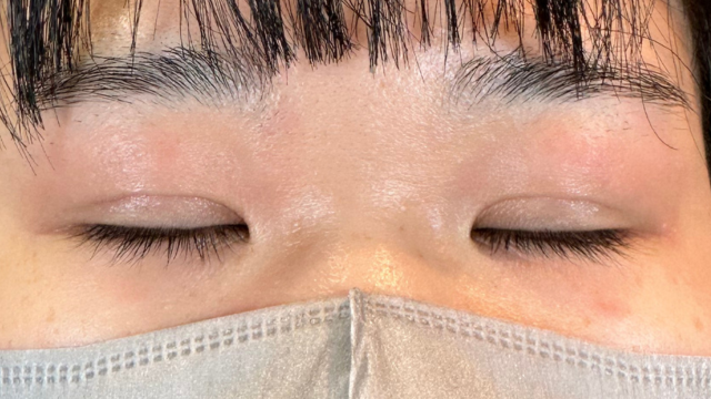 Postoperative Condition Part 1