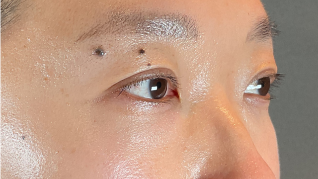 Postoperative Condition Part 1