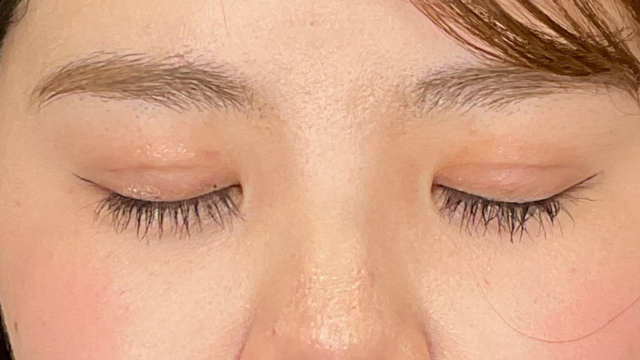 手术前的状态 其一