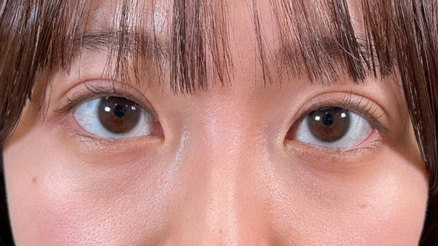 手术前的状态 其一