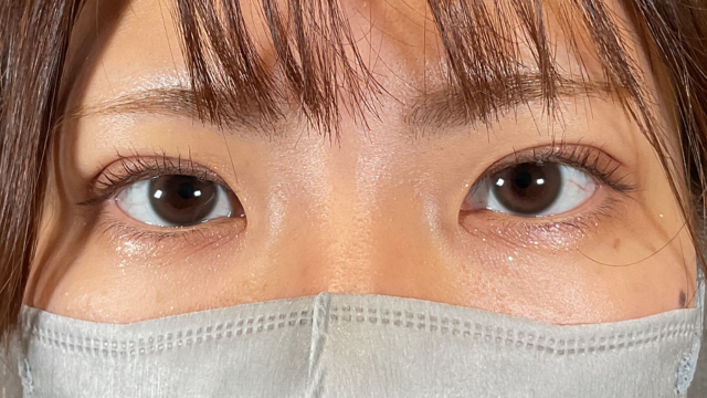 手术前的状态 其一