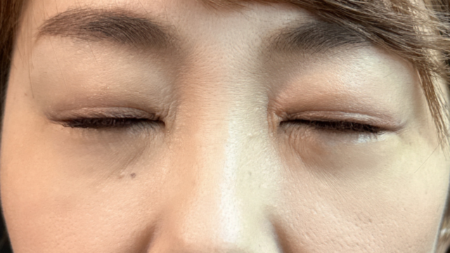 Postoperative Condition Part 1