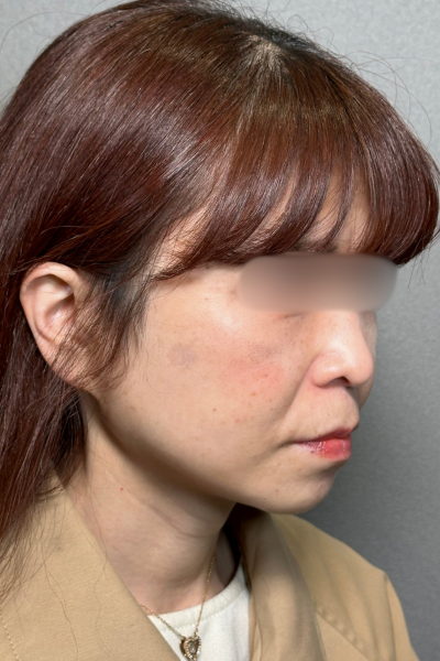 Postoperative Condition Part 1