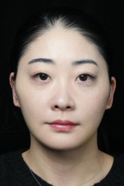 Postoperative Condition Part 1