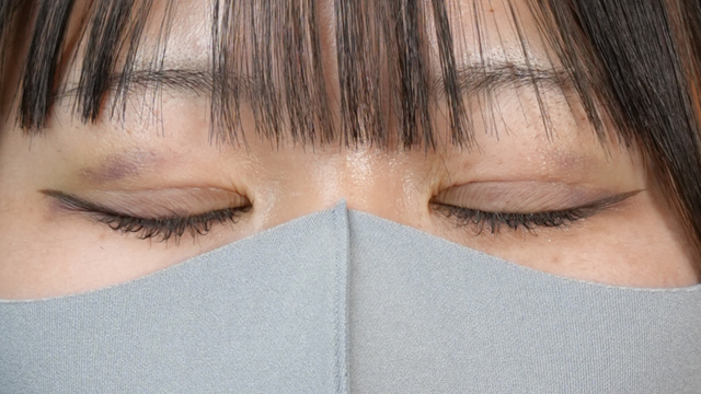 Postoperative Condition Part 1