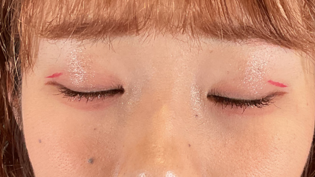 手术前的状态 其一