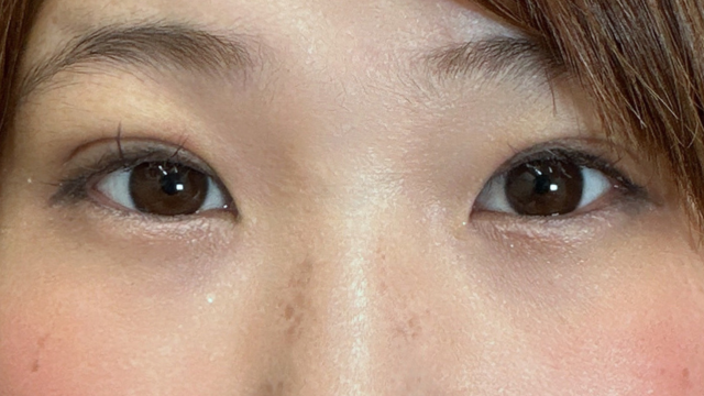 Postoperative Condition Part 1