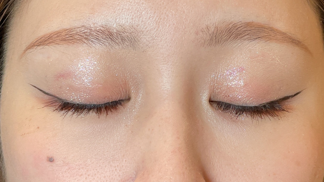 Postoperative Condition Part 1