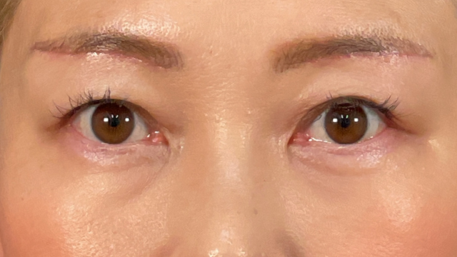 Postoperative Condition Part 1