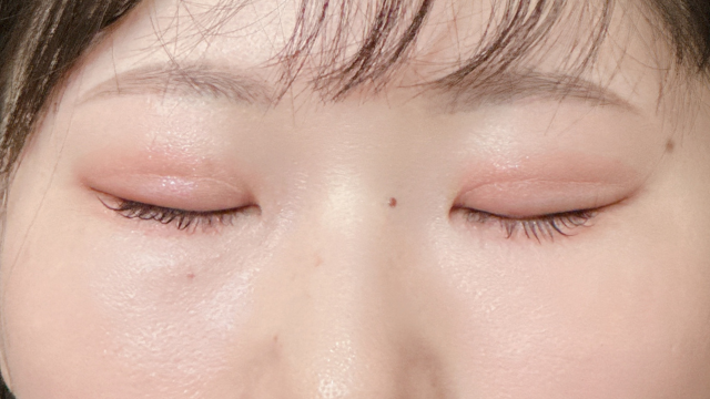 手术前的状态 其一