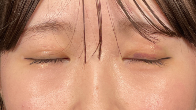 Postoperative Condition Part 1