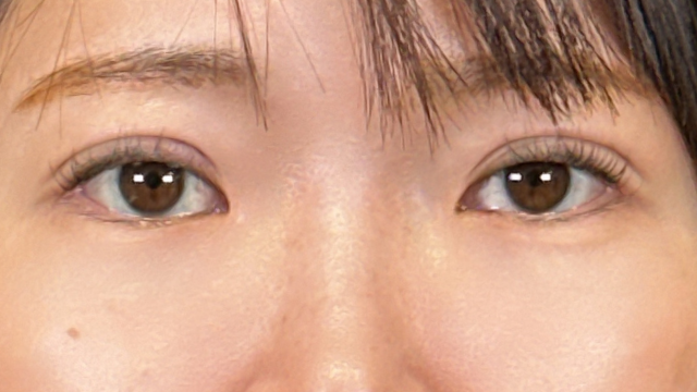 手术前的状态 其一