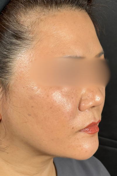 手術前の状態 その1