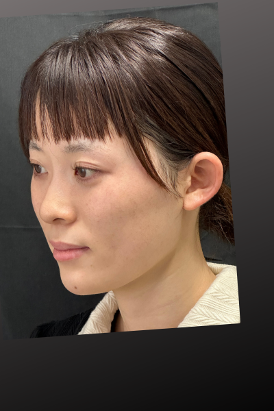 手術前の状態 その1