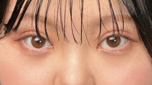 手术前的状态 其一