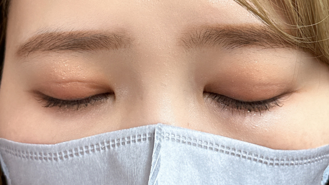 手术前的状态 其一