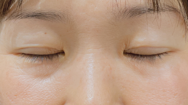 手术前的状态 其一