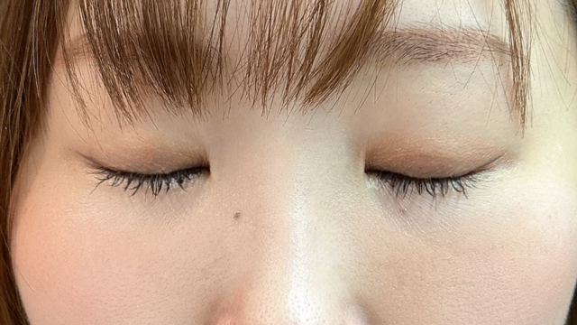 手术前的状态 其一