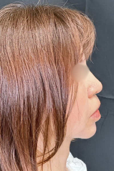 手術前の状態 その1