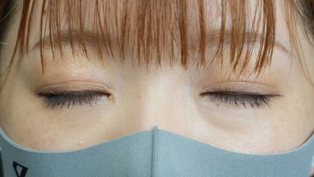 手术前的状态 其一