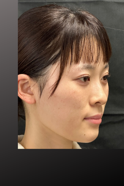 手術前の状態 その1