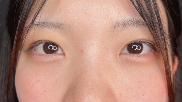 手术前的状态 其一