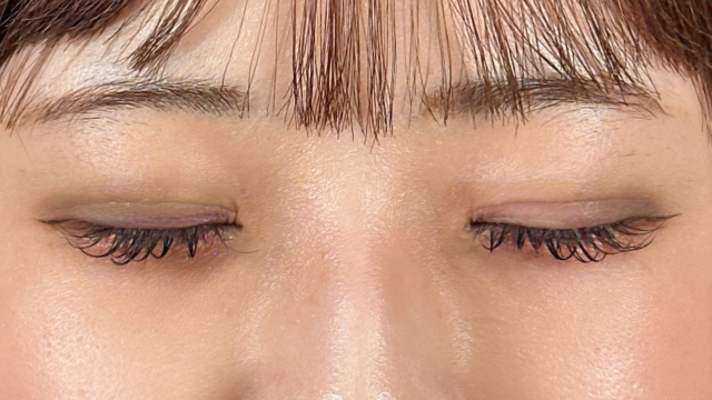 手术前的状态 其一