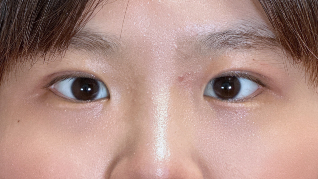 手术前的状态 其一