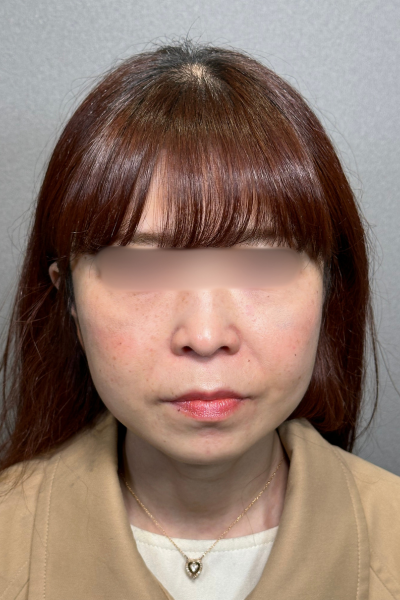 Postoperative Condition Part 1