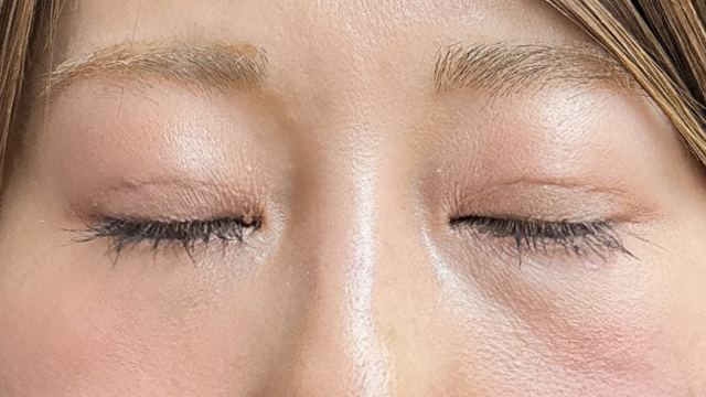 手术前的状态 其一