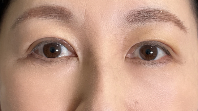 手术前的状态 其一