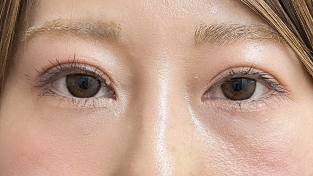 手术前的状态 其一