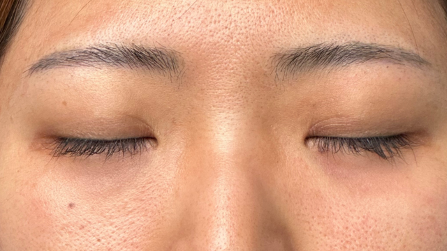 Postoperative Condition Part 1