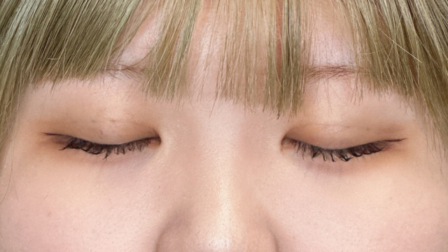 手术前的状态 其一