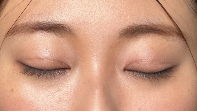 手術前の状態 その1