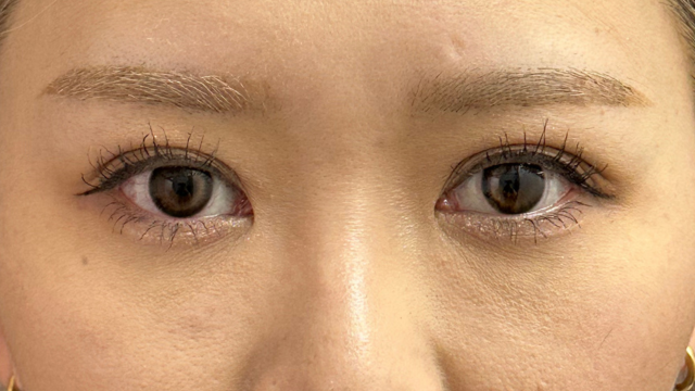 手术前的状态 其一